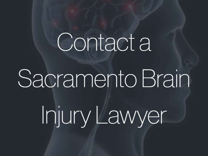 Sacramento Brain Injury Attorneys